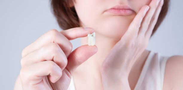 Wisdom Teeth Removal Adelaide Choosing the Right Dentist for Your Surgery Wisdom Teeth Removal Adelaide