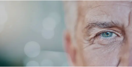 LASIK Eye Surgery in Adelaide’ Everything You Need to Know About the Procedure, Recovery, and Alternatives